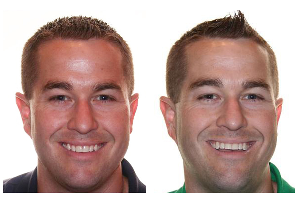 MD Family Dental Care